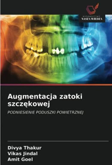 Augmentacja zatoki szcz¿kowej