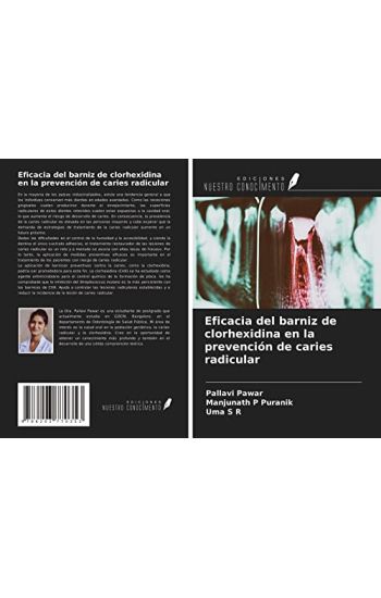 Eficacia del barniz de clorhexidina en la prevención de caries radicular