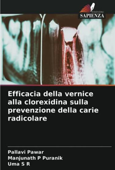 Efficacia della vernice alla clorexidina sulla prevenzione della carie radicolare
