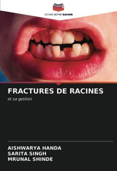 FRACTURES DE RACINES