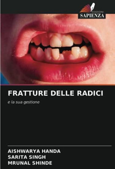 FRATTURE DELLE RADICI