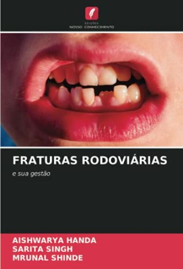 FRATURAS RODOVIÁRIAS