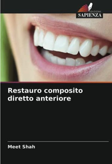 Restauro composito diretto anteriore