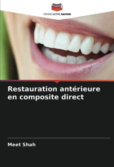 Restauration antérieure en composite direct