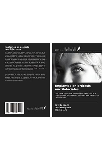 Implantes en prótesis maxilofaciales