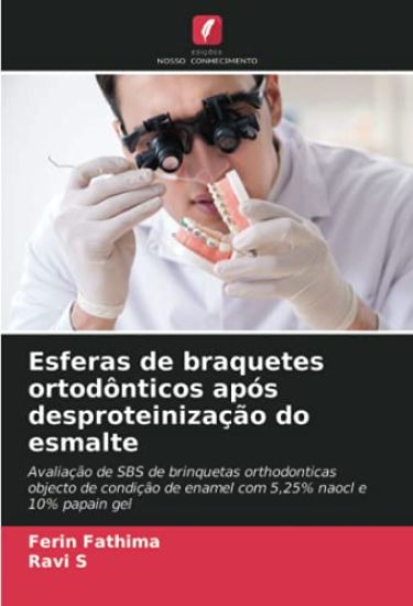 Esferas de braquetes ortodônticos após desproteinização do esmalte