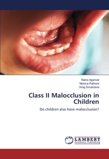 Class II Malocclusion in Children