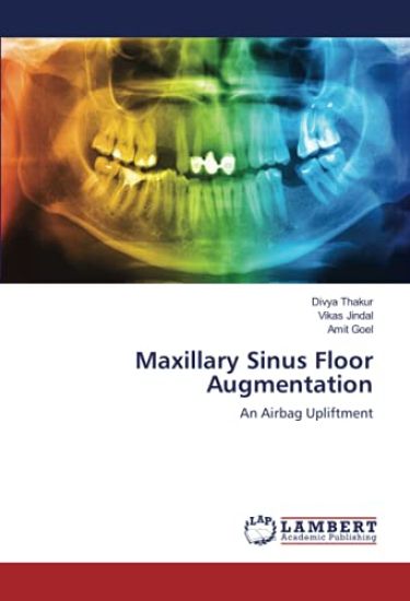 Maxillary Sinus Floor Augmentation