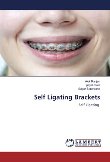 Self Ligating Brackets