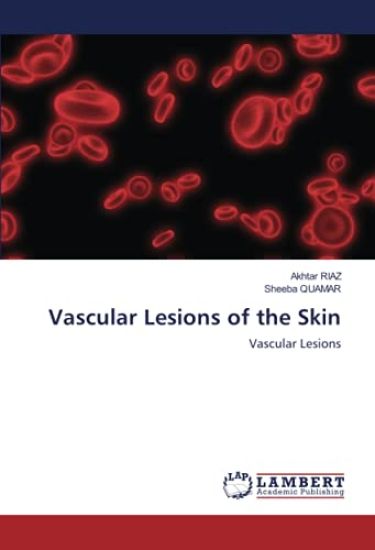 Vascular Lesions of the Skin