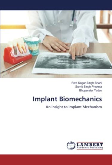 Implant Biomechanics