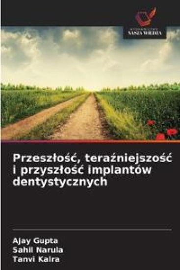 Przesz¿o¿¿, tera¿niejszo¿¿ i przysz¿o¿¿ implantów dentystycznych