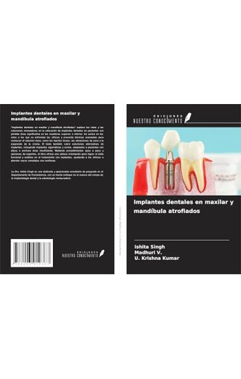 Implantes dentales en maxilar y mandíbula atrofiados