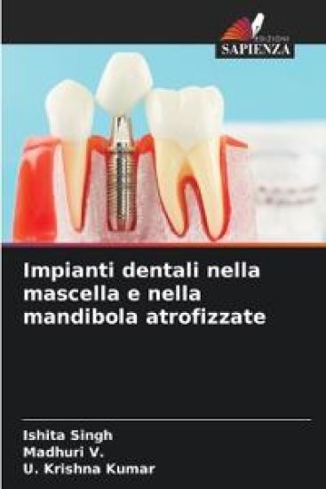 Impianti dentali nella mascella e nella mandibola atrofizzate