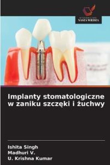 Implanty stomatologiczne w zaniku szcz¿ki i ¿uchwy