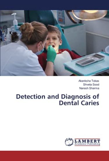 Detection and Diagnosis of Dental Caries