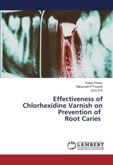 Effectiveness of Chlorhexidine Varnish on Prevention of Root Caries