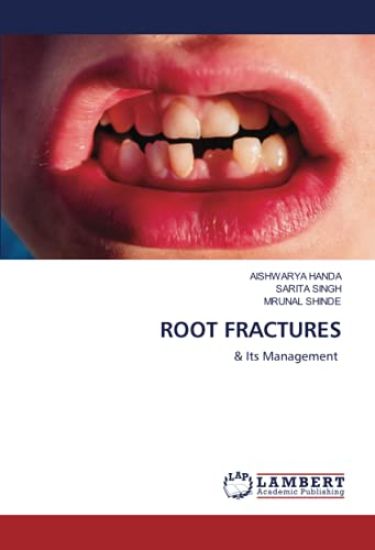 ROOT FRACTURES