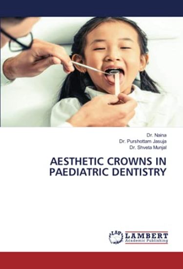 AESTHETIC CROWNS IN PAEDIATRIC DENTISTRY