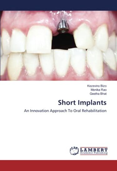 Short Implants