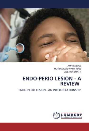 ENDO-PERIO LESION - A REVIEW