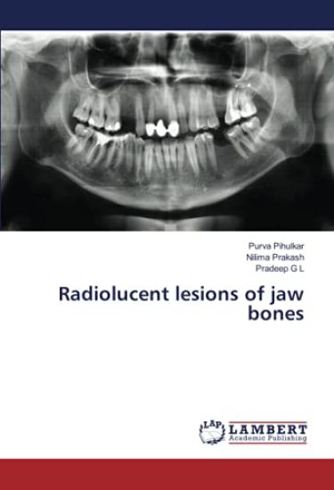 Radiolucent lesions of jaw bones