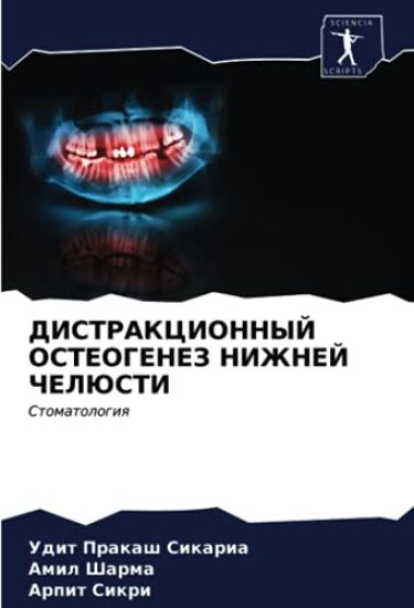 DISTRAKCIONNYJ OSTEOGENEZ NIZhNEJ ChELJuSTI