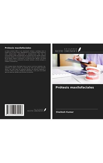 Prótesis maxilofaciales