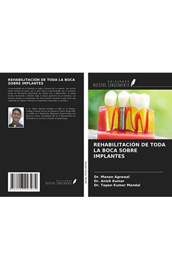 REHABILITACIÓN DE TODA LA BOCA SOBRE IMPLANTES
