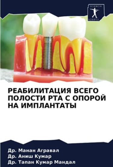 REABILITACIYa VSEGO POLOSTI RTA S OPOROJ NA IMPLANTATY