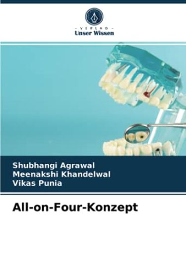 All-on-Four-Konzept