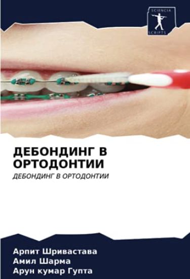 DEBONDING V ORTODONTII – Arpit Shriwastawa, kirjan kansikuva