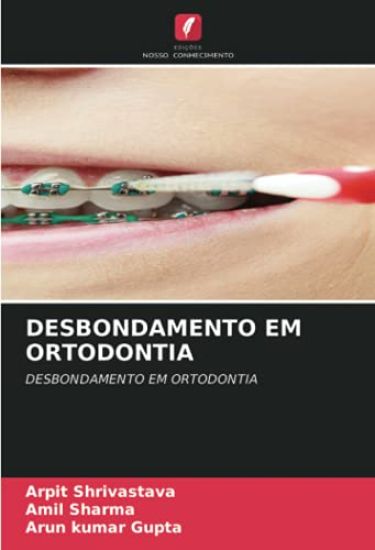 DESBONDAMENTO EM ORTODONTIA – Arpit Shrivastava, kirjan kansikuva