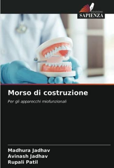 Morso di costruzione