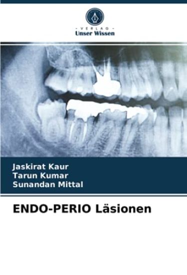 ENDO-PERIO Läsionen