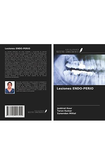 Lesiones ENDO-PERIO