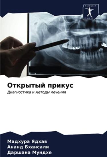 Otkrytyj prikus