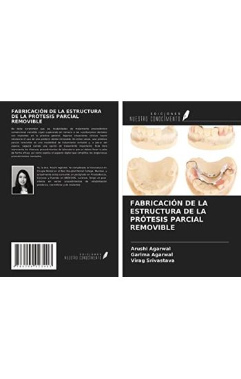 FABRICACIÓN DE LA ESTRUCTURA DE LA PRÓTESIS PARCIAL REMOVIBLE