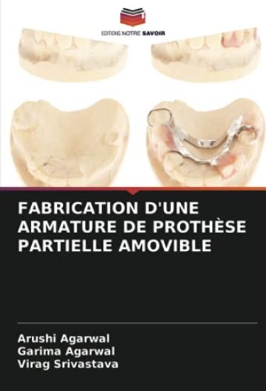 FABRICATION D'UNE ARMATURE DE PROTHÈSE PARTIELLE AMOVIBLE