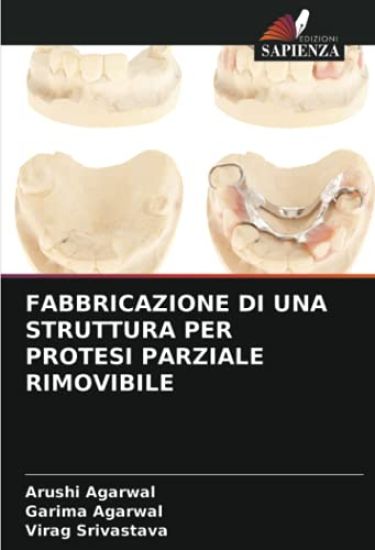 FABBRICAZIONE DI UNA STRUTTURA PER PROTESI PARZIALE RIMOVIBILE
