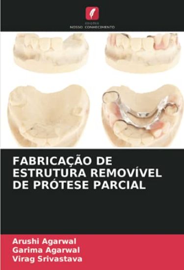 FABRICAÇÃO DE ESTRUTURA REMOVÍVEL DE PRÓTESE PARCIAL