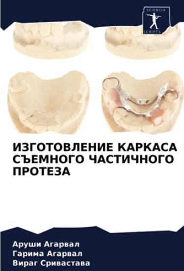 IZGOTOVLENIE KARKASA S#EMNOGO ChASTIChNOGO PROTEZA