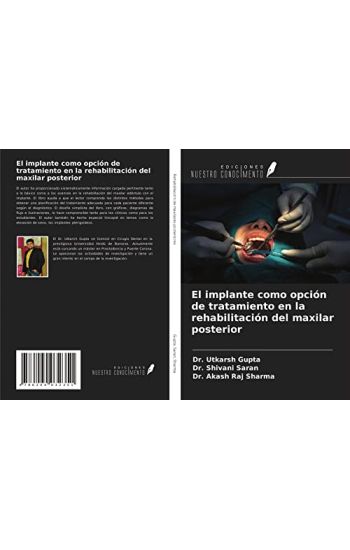 El implante como opción de tratamiento en la rehabilitación del maxilar posterior