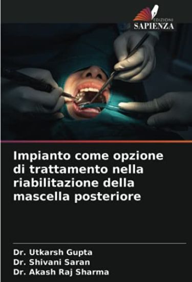 Impianto come opzione di trattamento nella riabilitazione della mascella posteriore