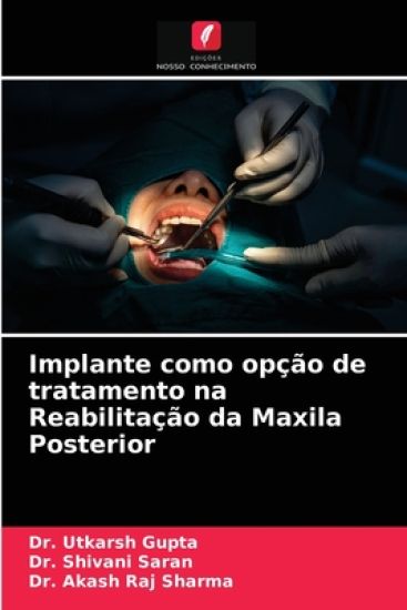 Implante como opção de tratamento na Reabilitação da Maxila Posterior