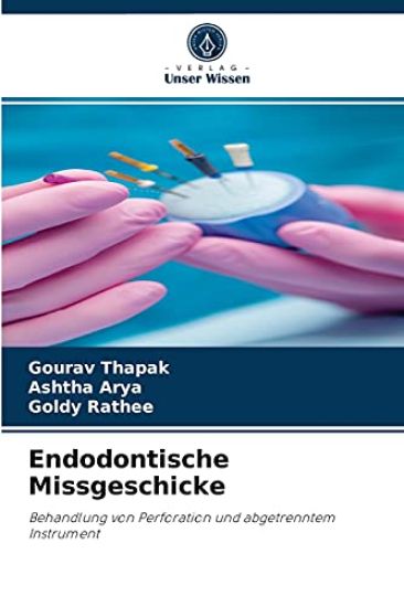 Endodontische Missgeschicke