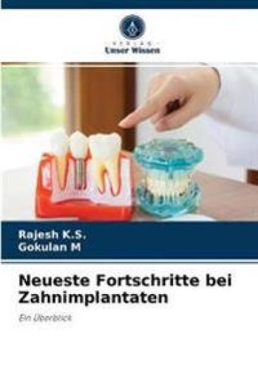 Neueste Fortschritte bei Zahnimplantaten
