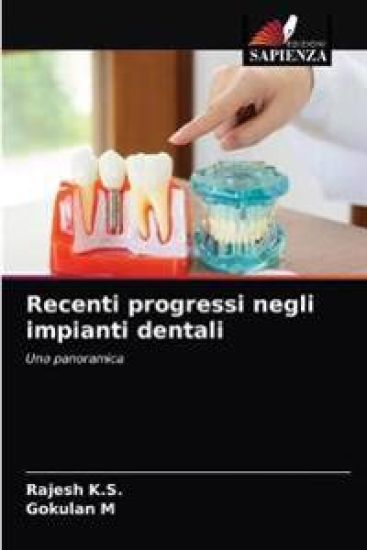 Recenti progressi negli impianti dentali