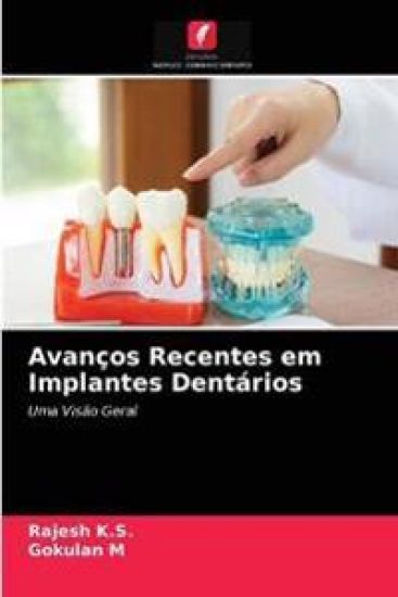 Avanços Recentes em Implantes Dentários