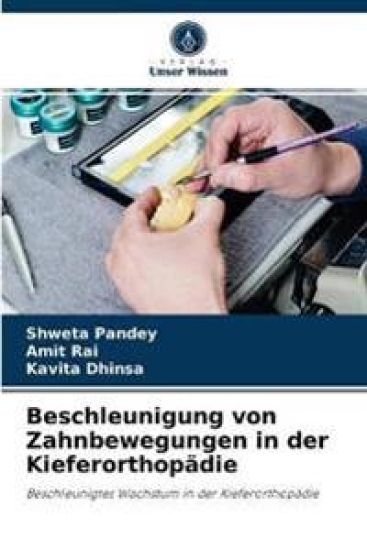 Beschleunigung von Zahnbewegungen in der Kieferorthopädie
